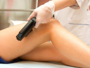 Kimlere lazer epilasyonu yapılmaz