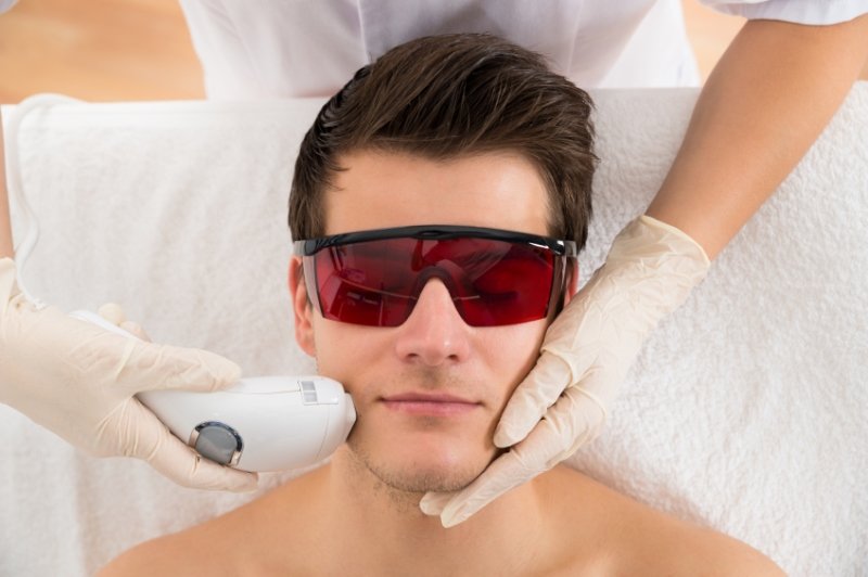 Lazer epilasyon nasıl yapılır