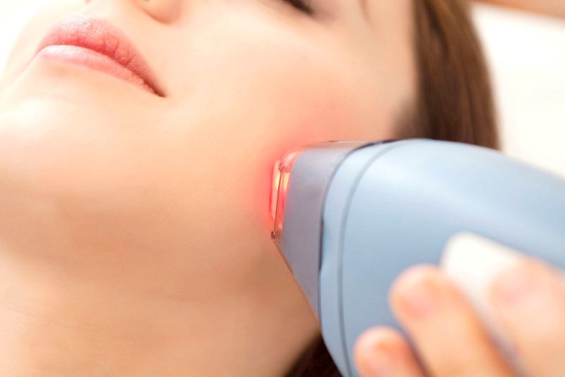 Lazer epilasyonun zararları