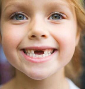 Süt dişleri kaç yaşında dökülür