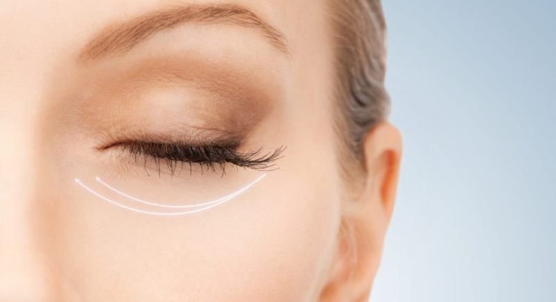 Göz Çevresi Bakımı Nasıl Yapılır