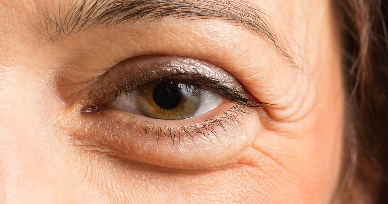 Göz çevresi bakımı için bitkisel yağlar