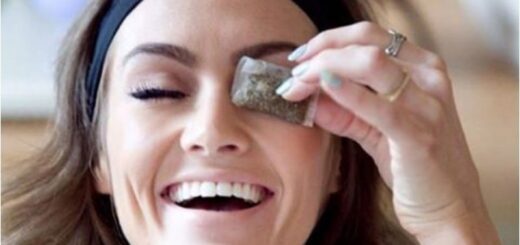 göz altı torbalarına bitkisel çözüm